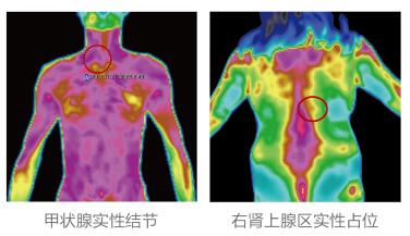 医用红外热像仪体检安全性怎么样