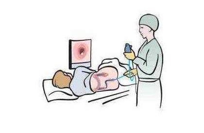 肠道检查红外扫描和肠镜那个比较好