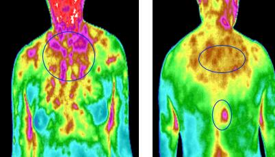 什么是红外热成像