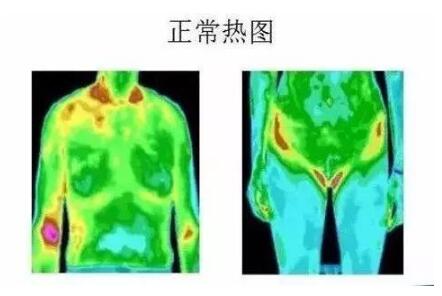 为什么要选择医用红外热像仪