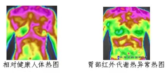 红外热成像扫描（GTT）的“功能检测”