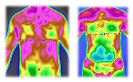 胸闷、心悸、呼吸困难......冠心病可能正在危害你的健康，警惕猝死风险